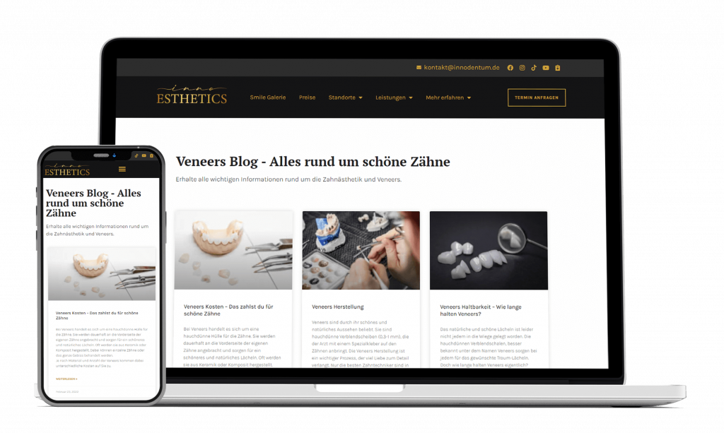 Blog Website gestalten lassen